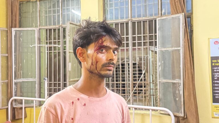दुकान में घुसकर व्यापारी पर लाठी-डंडों से युवको ने किया जानलेवा हमला
