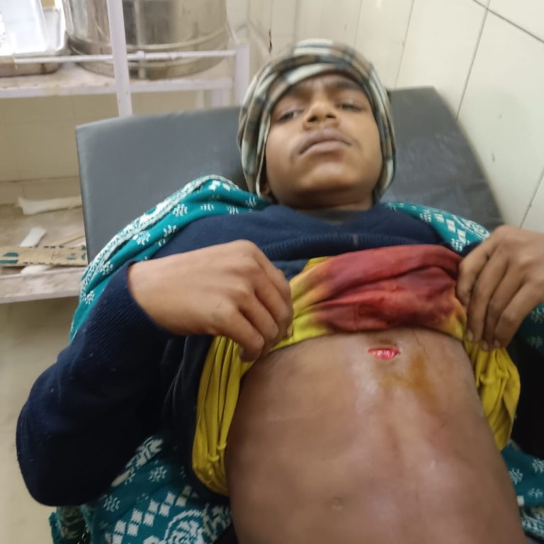 युवक पर बाइक सवार तीन अज्ञात लोगों ने हमला कर दिया और चाकू मारकर घायल कर दिया