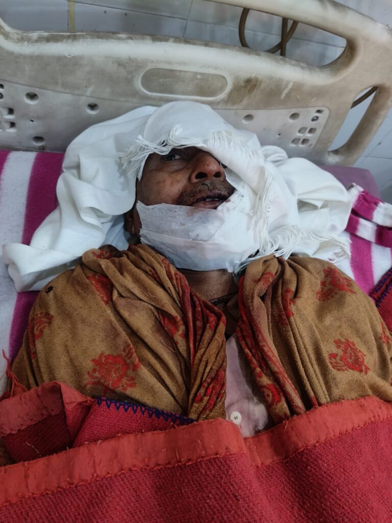 पुरानी रंजिश मे बीती रात बेखौफ दबंगों ने घर में घुसकर दंपति पर किया धारदार हथियार से जानलेवा हमला