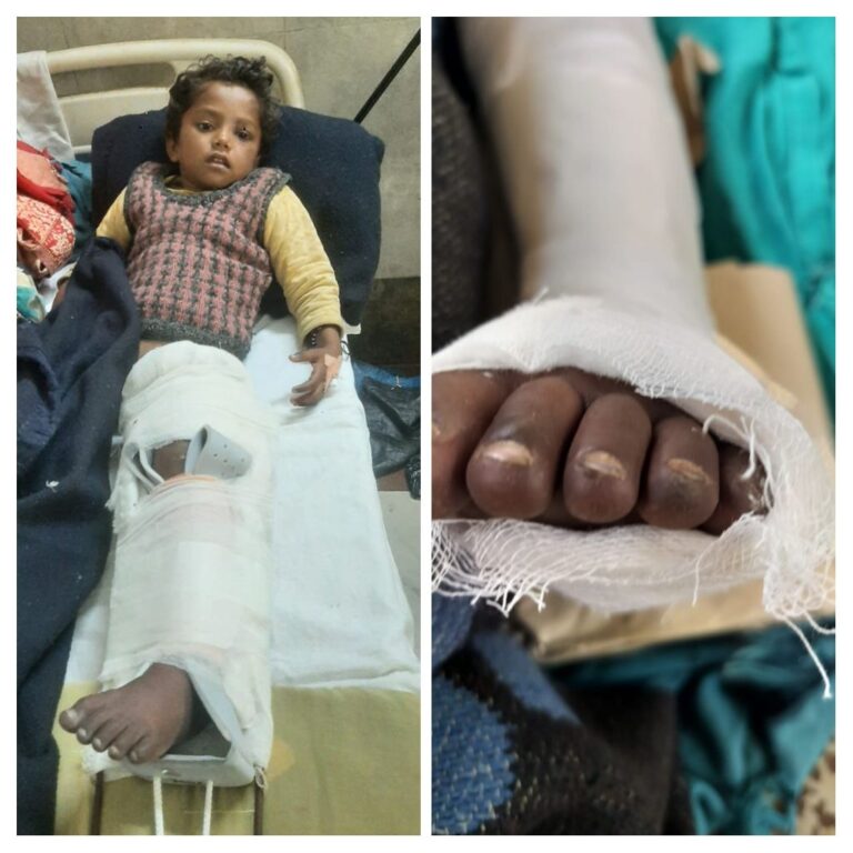 कलयुगी डाक्टर रूपी राक्षस ने मासूम को बना दिया अपाहिज